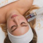 FRACTIONAL ABLATIVE LASER szczecin