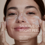 PEELING CHEMICZNY SZCZECIN