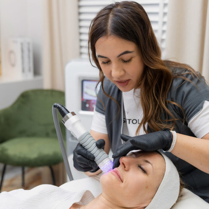 IMG_1586 Radiofrekwencja mikroigłowa