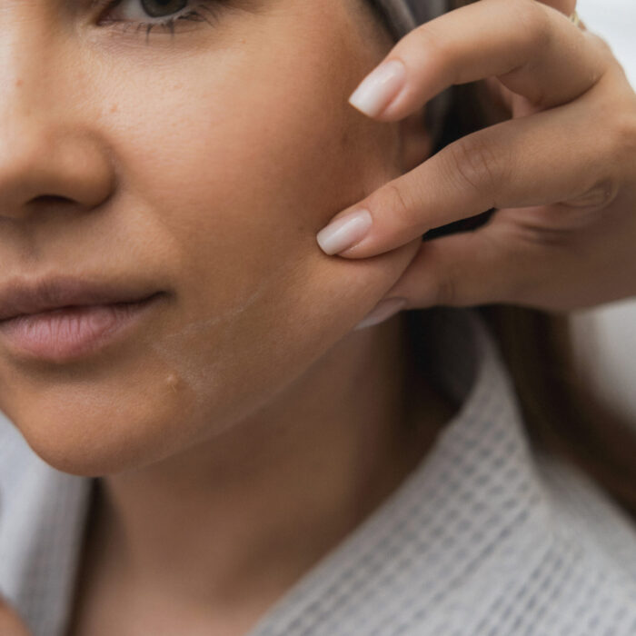 ENDERMOLOGIA TWARZY - MASAŻ szczecin ENDERMOLOGIA TWARZY - MASAŻ szczecin