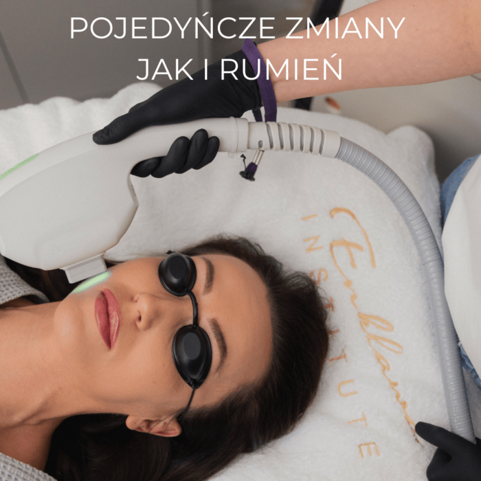 LASEROWE ZAMYKANIE NACZYNEK