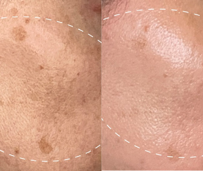 DERMALOGICA DERMALOGICA