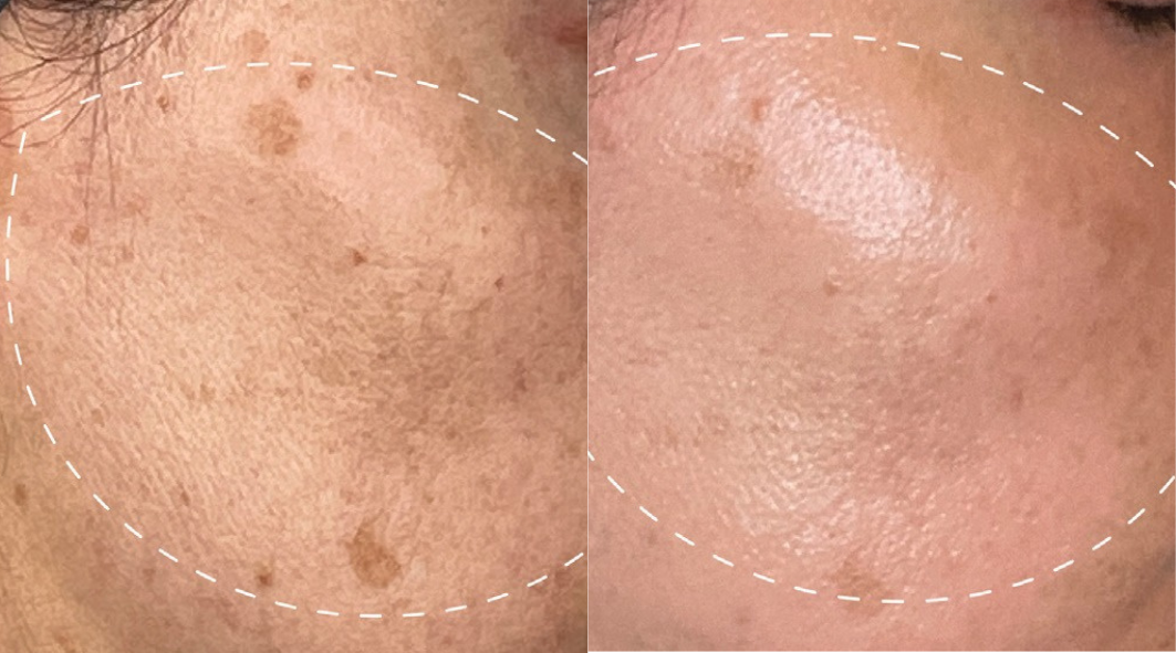 DERMALOGICA DERMALOGICA