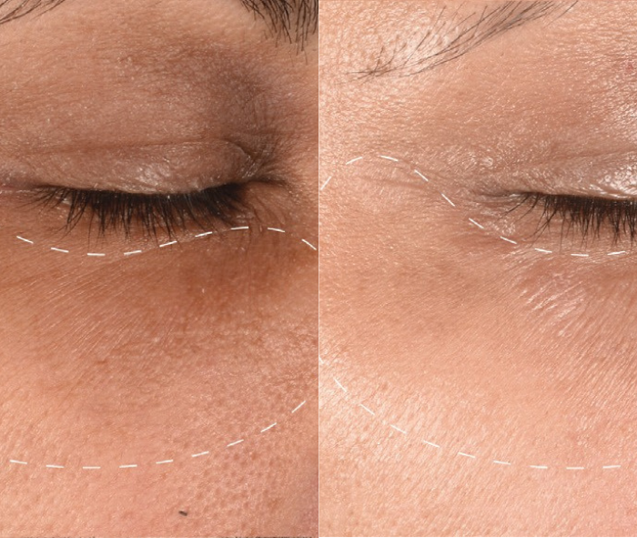 DERMALOGICA DERMALOGICA