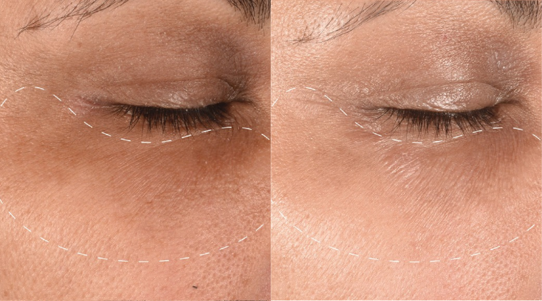 DERMALOGICA DERMALOGICA