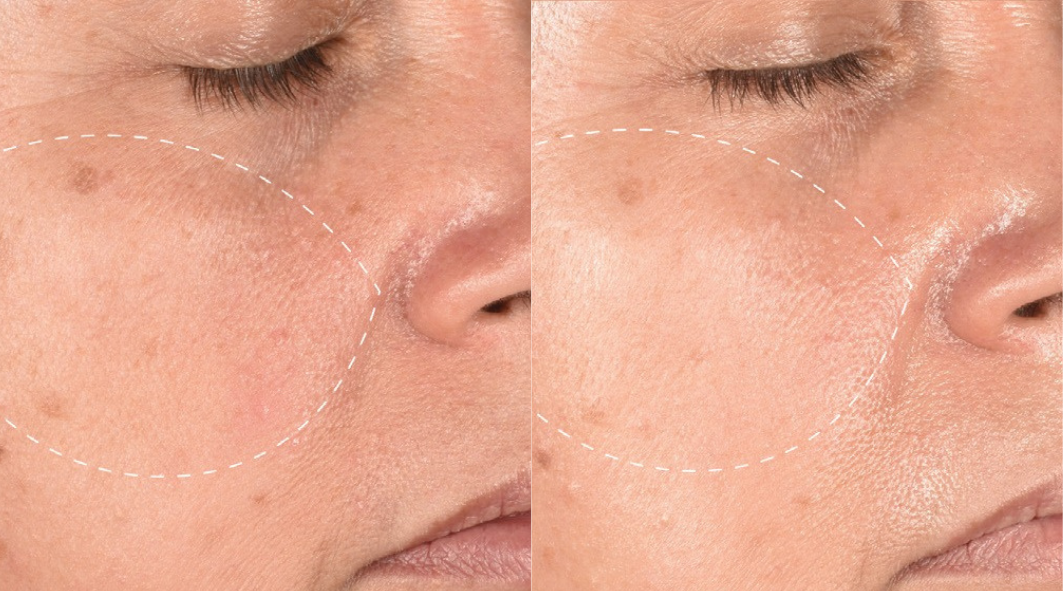 DERMALOGICA DERMALOGICA