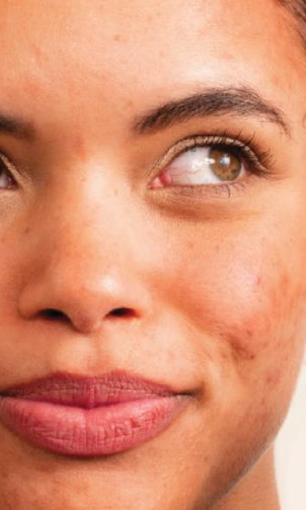 DERMALOGICA DERMALOGICA