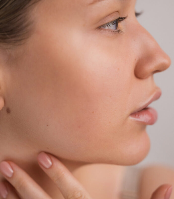 483A0043 KWAS POLIMLEKOWY