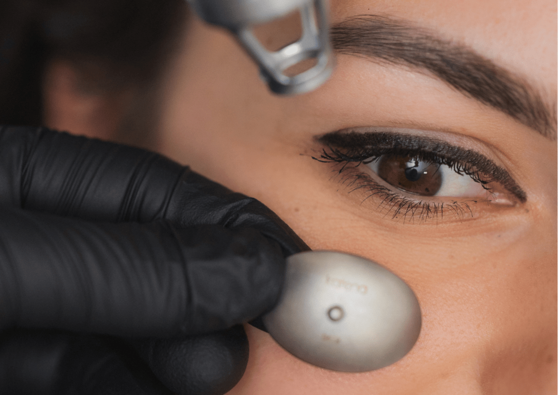 Fakty i mity na temat laserowego usuwania tatuażu i makijażu permanentnego