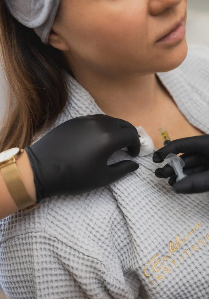 OSOCZE BOGATOPŁYTKOWE W SKÓRĘ GŁOWY OSOCZE BOGATOPŁYTKOWE W SKÓRĘ GŁOWY