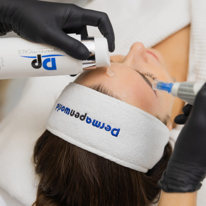 IMG_1344 Mezoterapia mikroigłowa